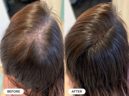 Revotín Repair Spray — Eliminates Thinning Hair