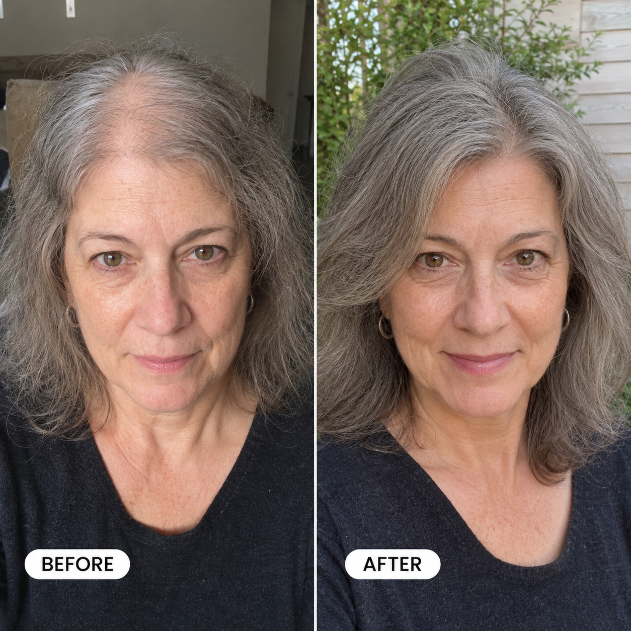 Revotín Repair Spray — Eliminates Thinning Hair